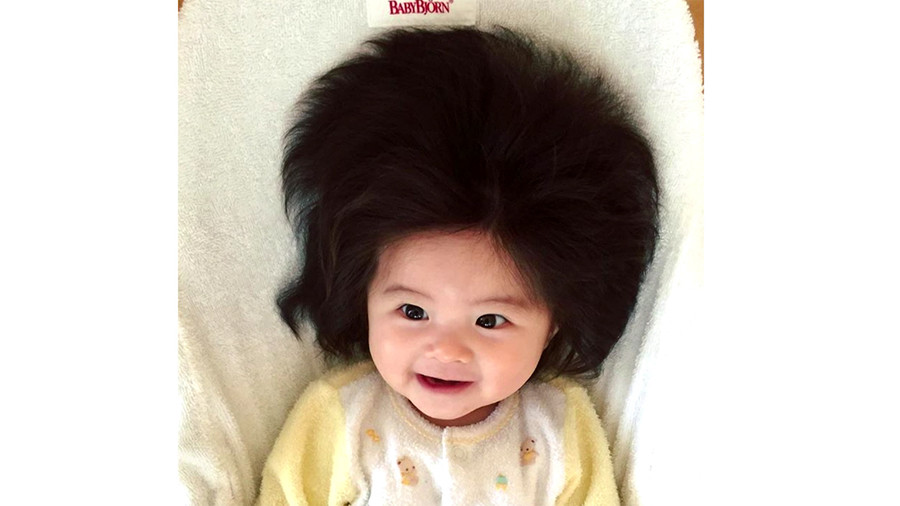 [最も選択された] 赤ちゃん 髪の毛 多い 281389赤ちゃん 髪の毛 多い 女の子